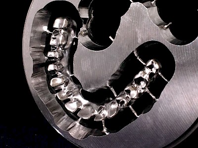 CoCr Implant bridge