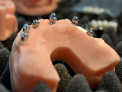 Dental Model