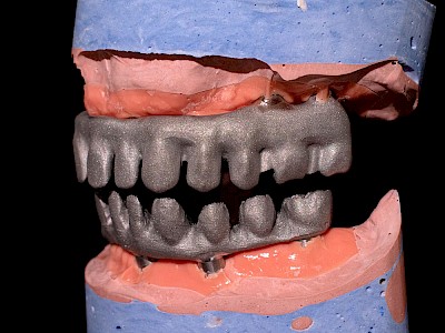 Hybrid Milling